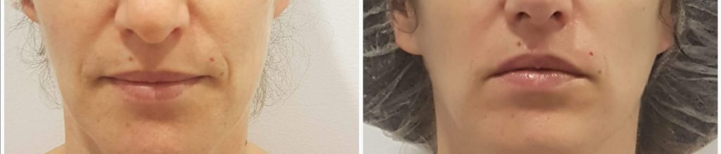 Tratamientos esteticos(1)